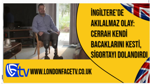 İngiltere’de Akılalmaz Olay: Cerrah Kendi Bacaklarını Kesti, Sigortayı Dolandırdı